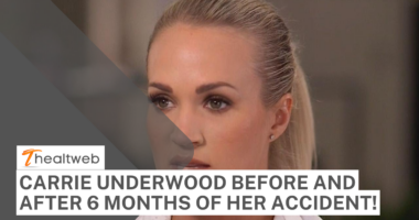 Carrie Underwood Before and After 6 Months of her Accident!