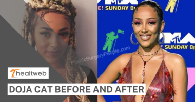 Doja Cat Before and After - COMPLETE DETAILS