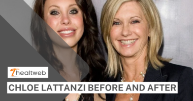 Chloe Lattanzi Before and After - COMPLETE DETAILS!
