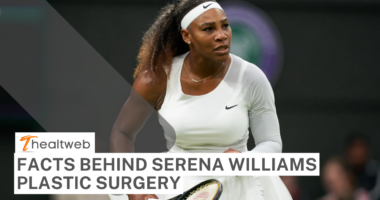 Facts Behind Serena Williams Plastic Surgery – Before and After! COMPLETE DETAILS