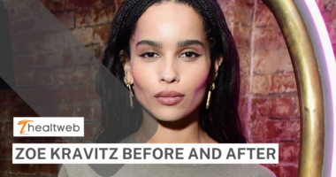 Zoe Kravitz Before and After - COMPLETE DETAILS!