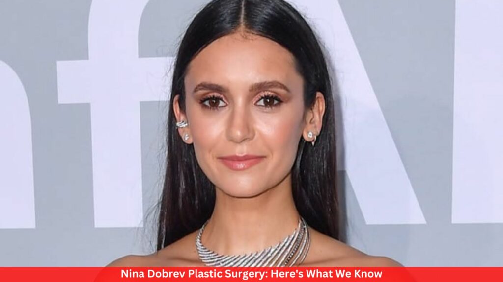 Nina Dobrev Plastic Surgery: Here's What We Know