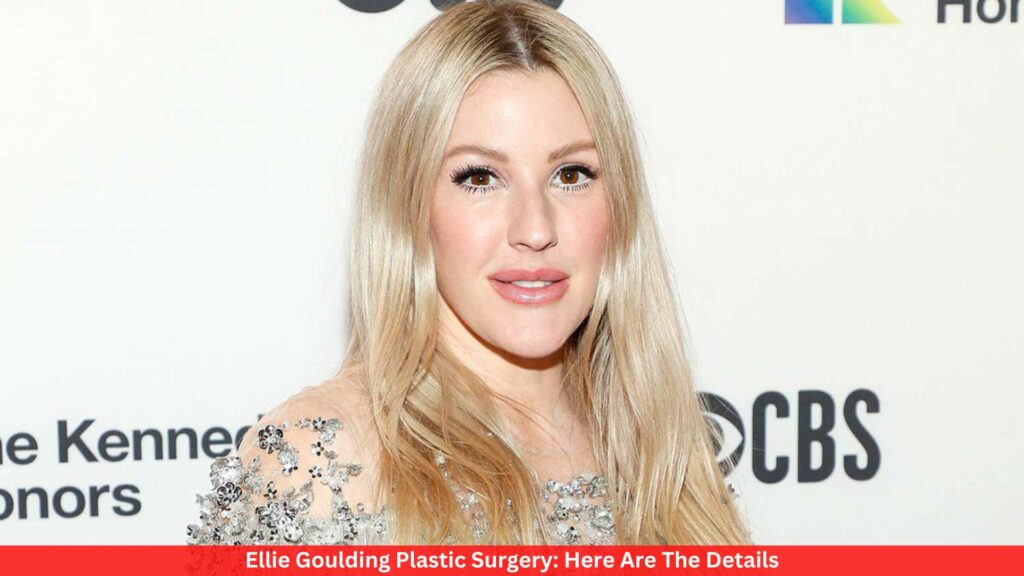Ellie Goulding Plastic Surgery: Here Are The Details