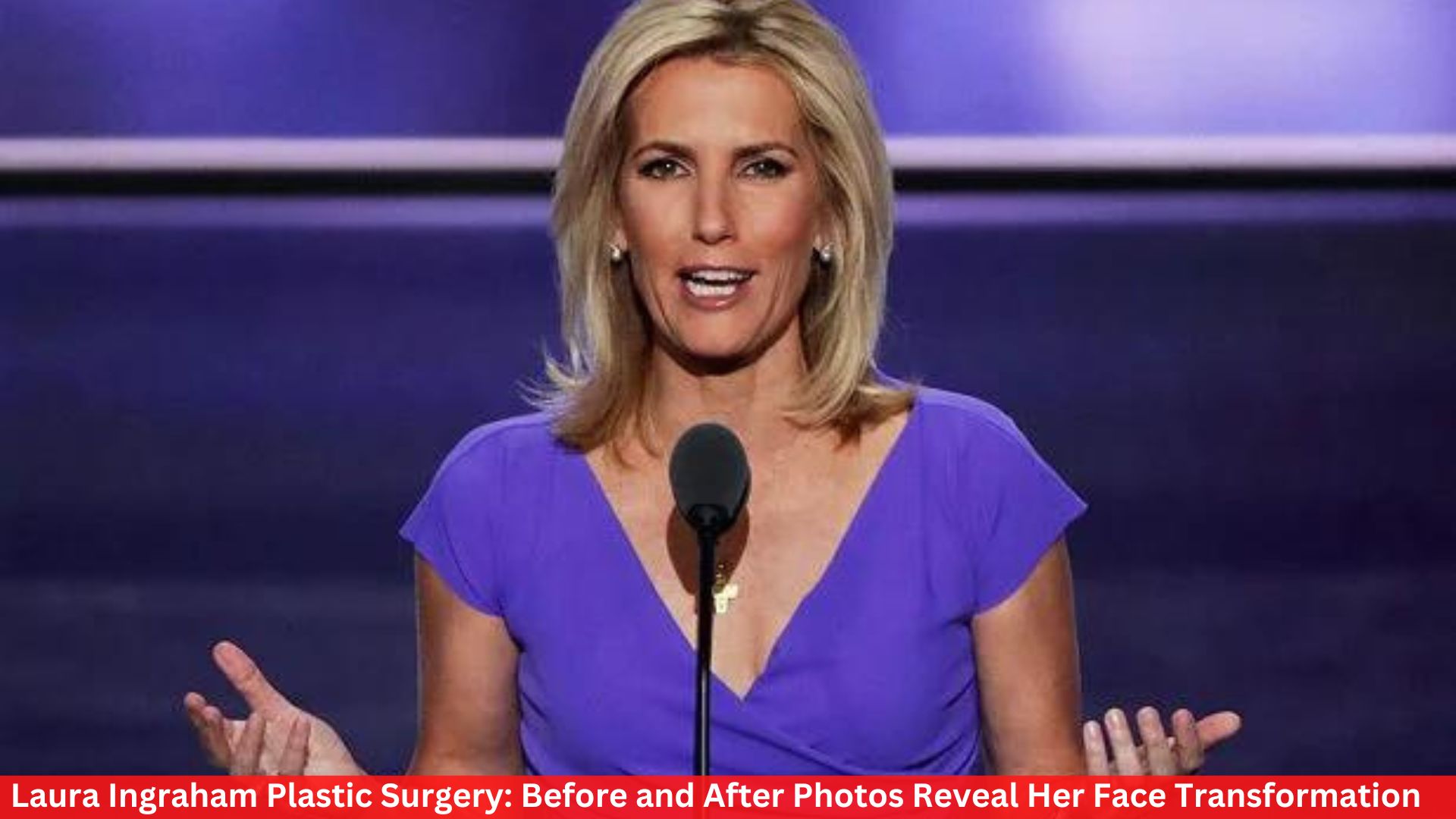 Laura Ingraham Plastic Surgery: Before and After Photos Reveal Her Face Transformation