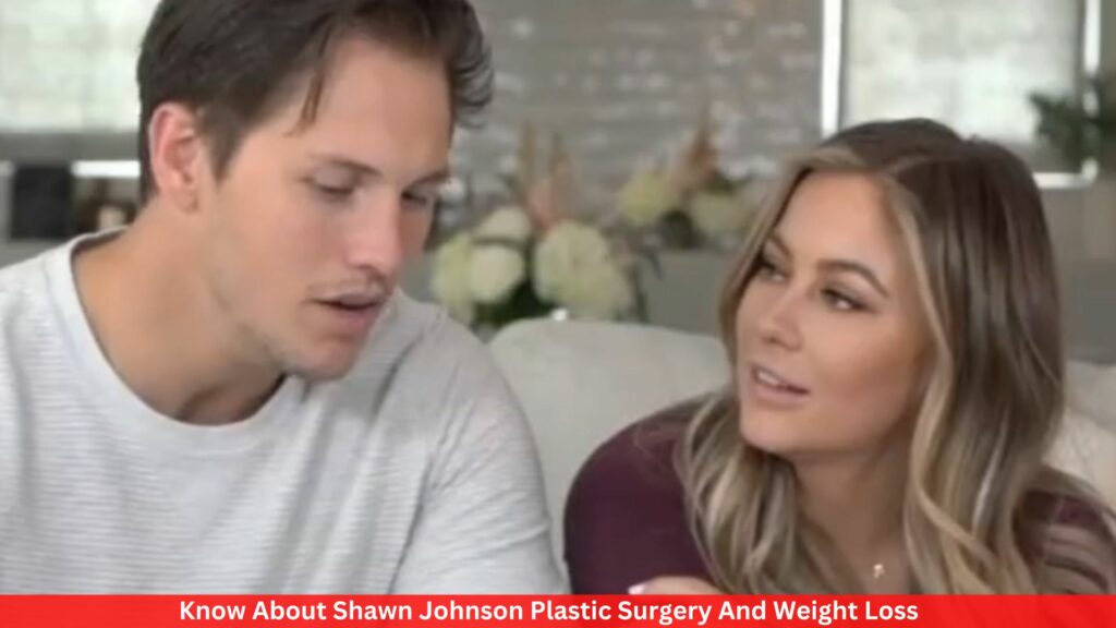 Know About Shawn Johnson Plastic Surgery And Weight Loss